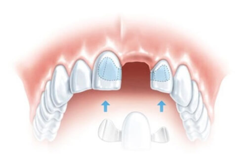 лечение зуба цена томск
